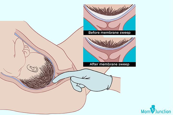 membrane sweep success rate 40 weeks