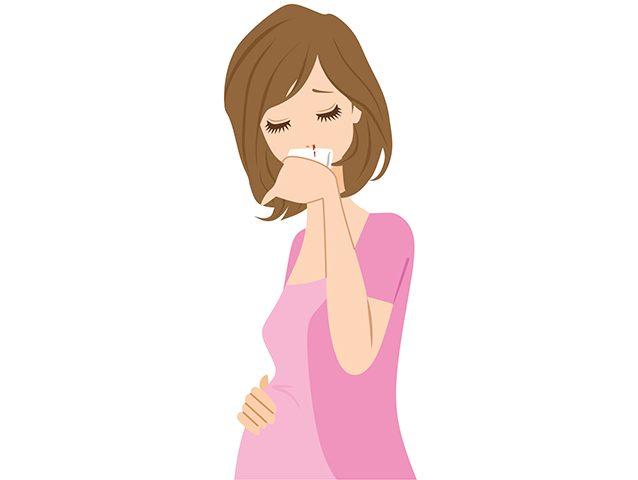 nosebleeds-during-pregnancy-causes-treatment-and-prevention