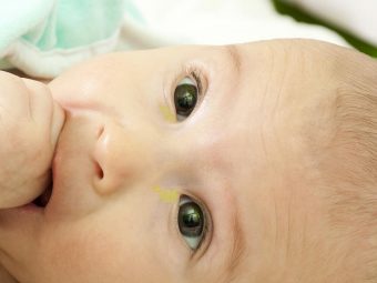 7-Effective-Tips-To-Treat-Sticky-Eyes-In-Infants