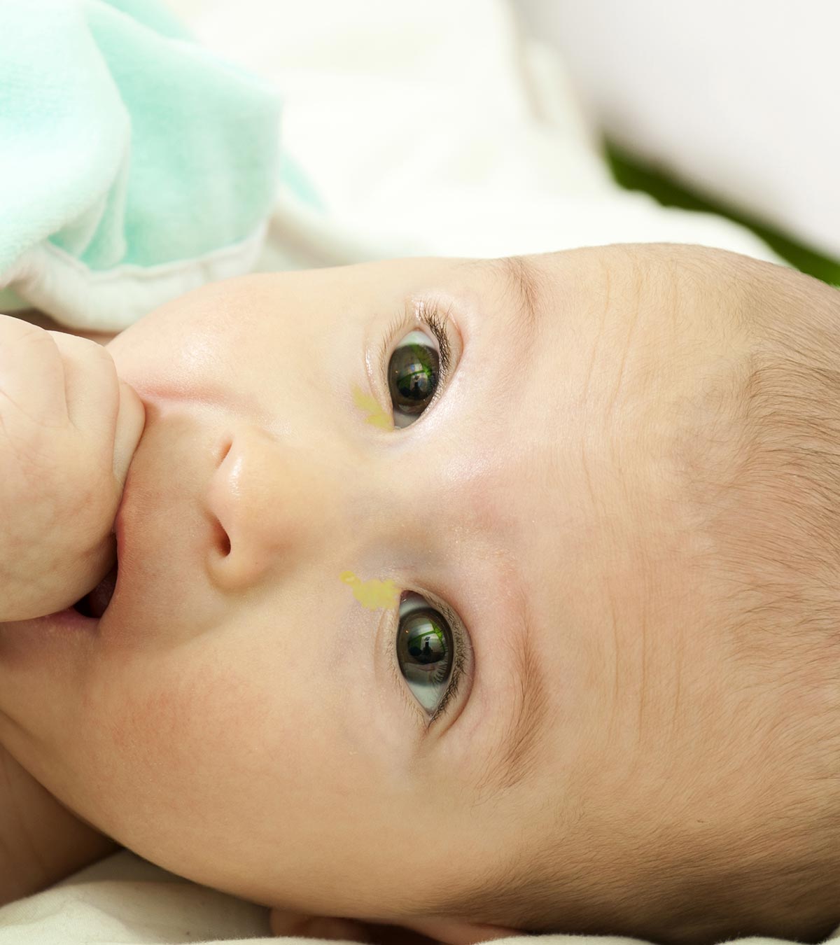 婴儿粘眼睛:原因、治疗、补救和预防