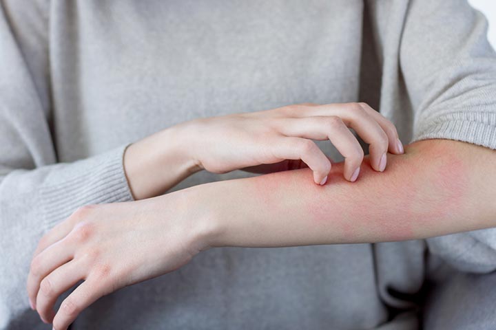 Common signs of allergic reactions may include rashes
