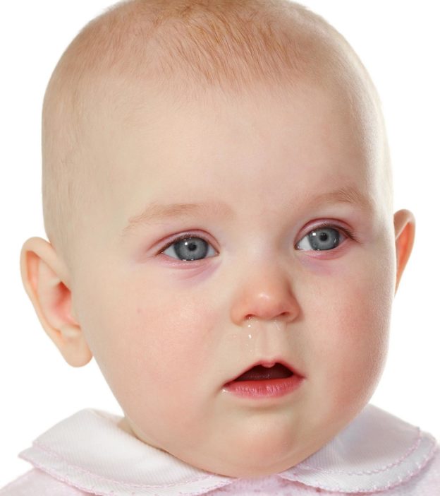 Pink Eye In Babies: Signs, Causes And Treatment