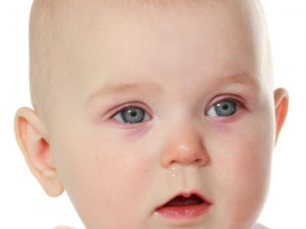 Pink Eye In Babies: Signs, Causes And Treatment