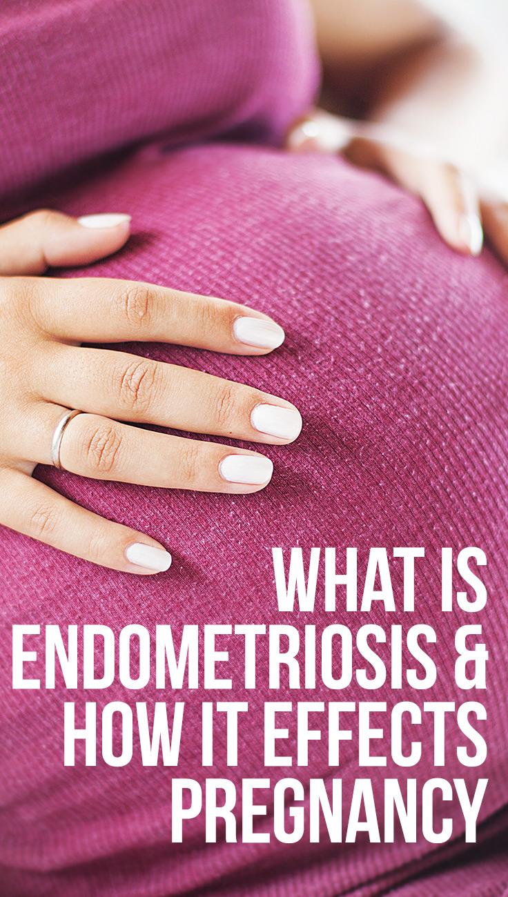 Can You Get Pregnant With Endometriosis?