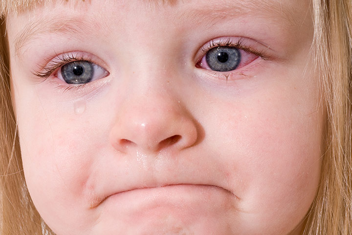 pink-eye-in-toddlers-3-causes-8-symptoms-4-treatments-you-should