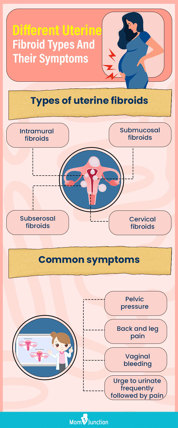 different uterine fibroid types and their symptoms (infographic)