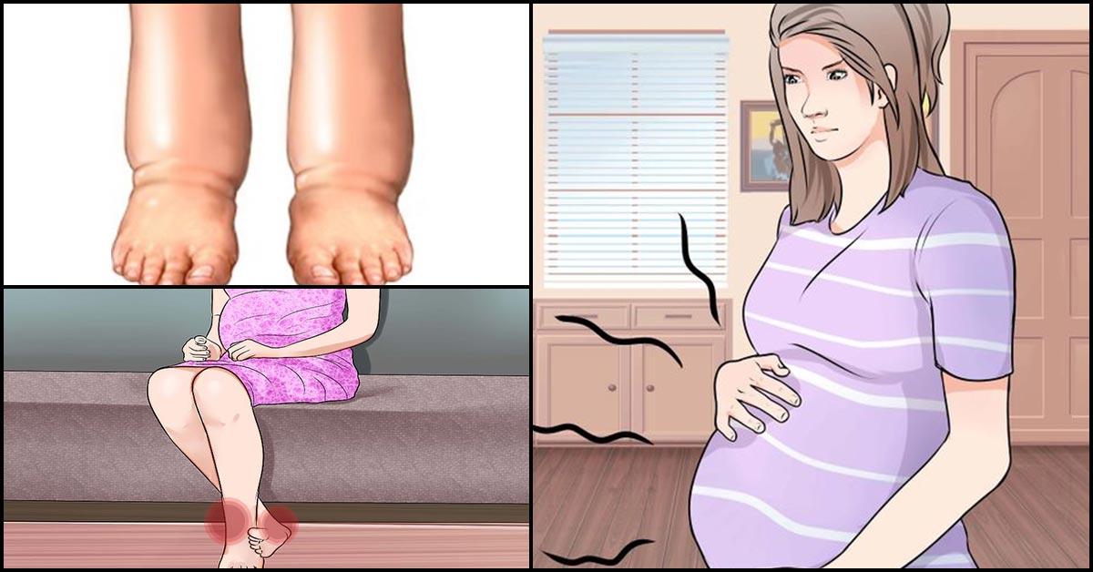 heel pain pregnancy