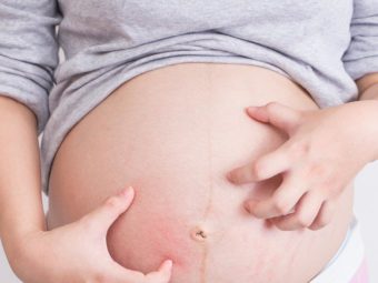 8 Home Remedies To Deal With Itchy Belly During Pregnancy