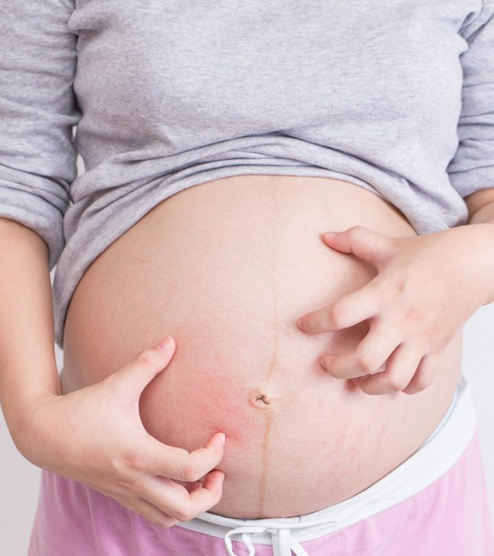 8 Home Remedies To Deal With Itchy Belly During Pregnancy