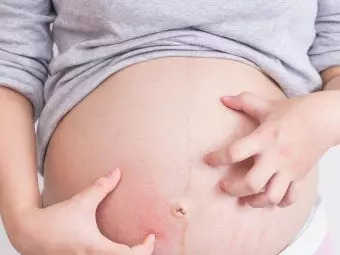 Itchy Belly During Pregnancy: Causes, Remedies, And Treatment