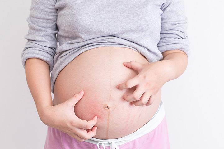 How To Prevent Big Belly During Pregnancy