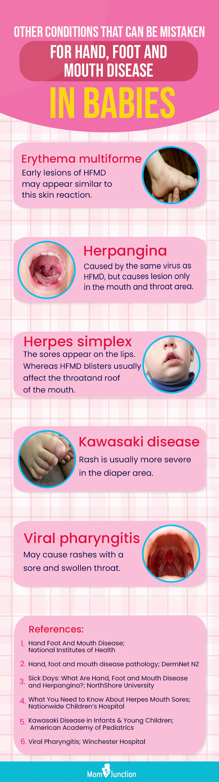 symptoms similar to hfmd (infographic)
