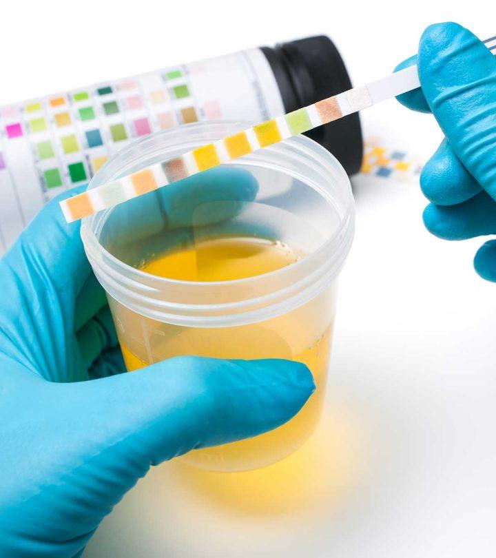 Protein In Urine When Pregnant Causes And Ways To Treat It