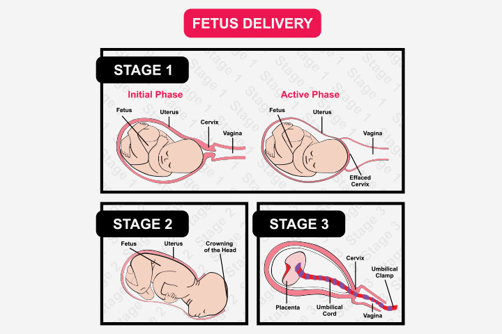 postpartum retained placental fragments