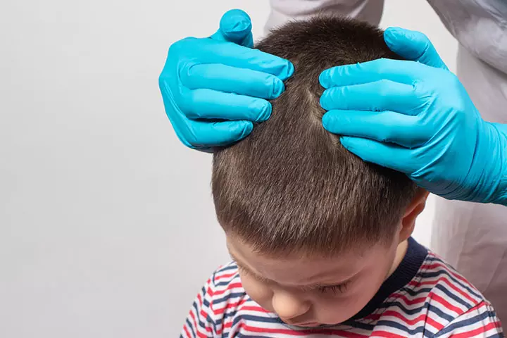 Round bald spots on children