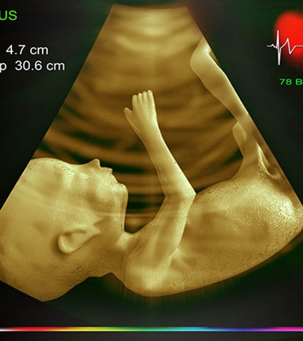 Fetal Echocardiography: Importance, Procedure, Risks