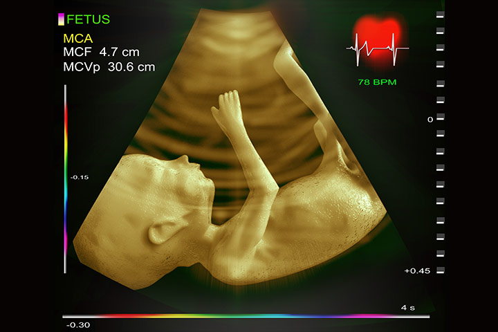 2019 heart test What It And Fetal Echocardiogram Is Is Why Done?