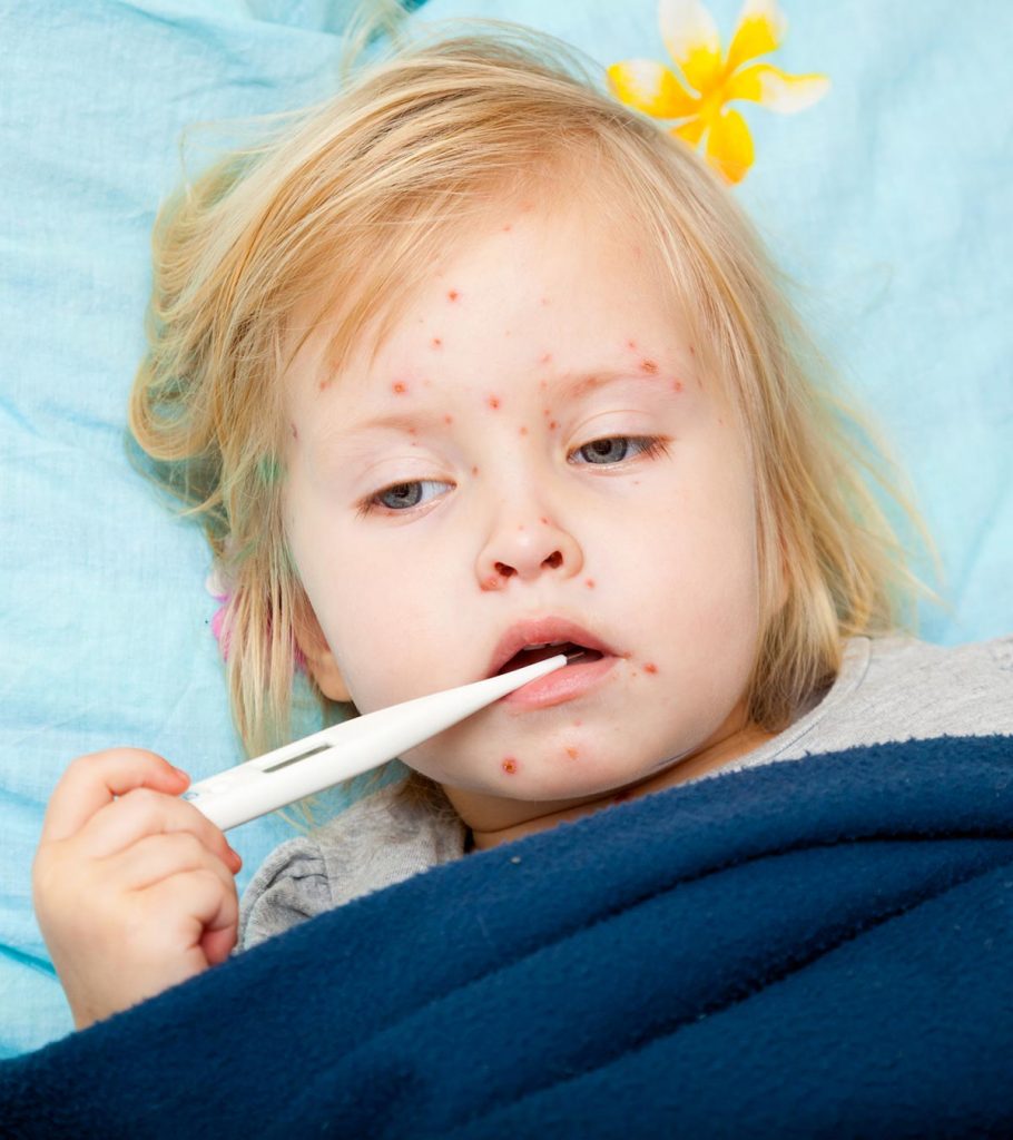 Grooming Activities Children That Creative in 2022 13 Symptoms Of Meningitis In Toddlers, Risks, And Treatment