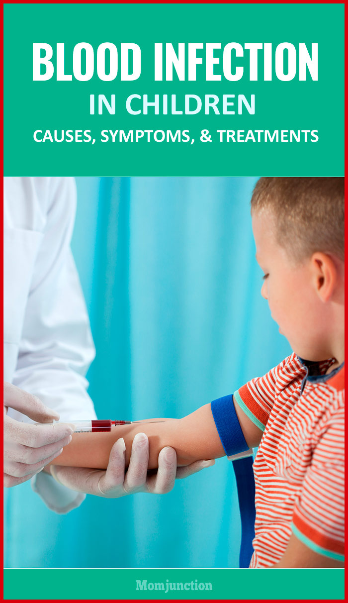 sepsis-in-children-causes-symptoms-and-prevention