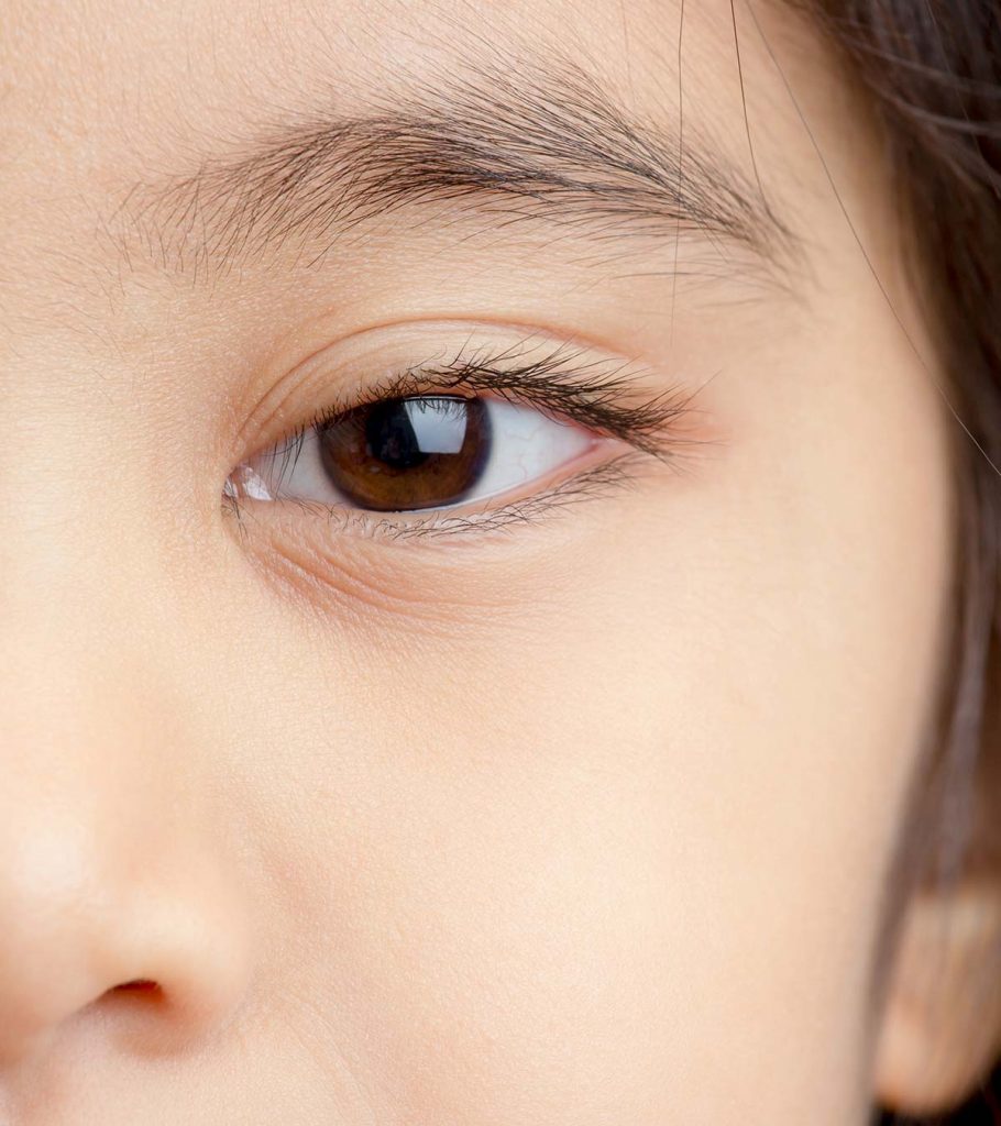 Corneal Abrasion In Children Causes, Symptoms And Treatment