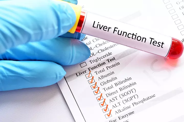 LFT helps diagnose intrahepatic cholestasis