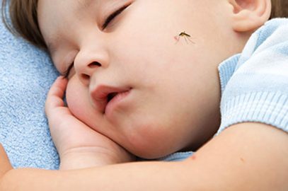 5 Effective Tips To Treat Mosquito Bites In Toddlers