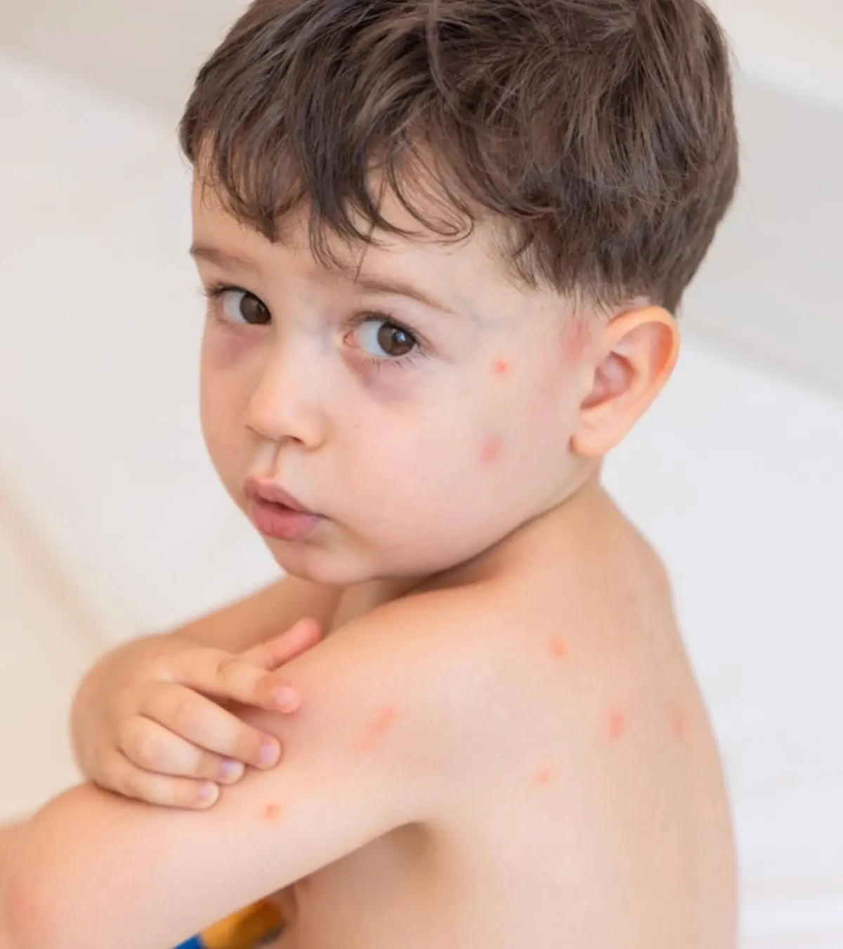 Mosquito biting to the toddler