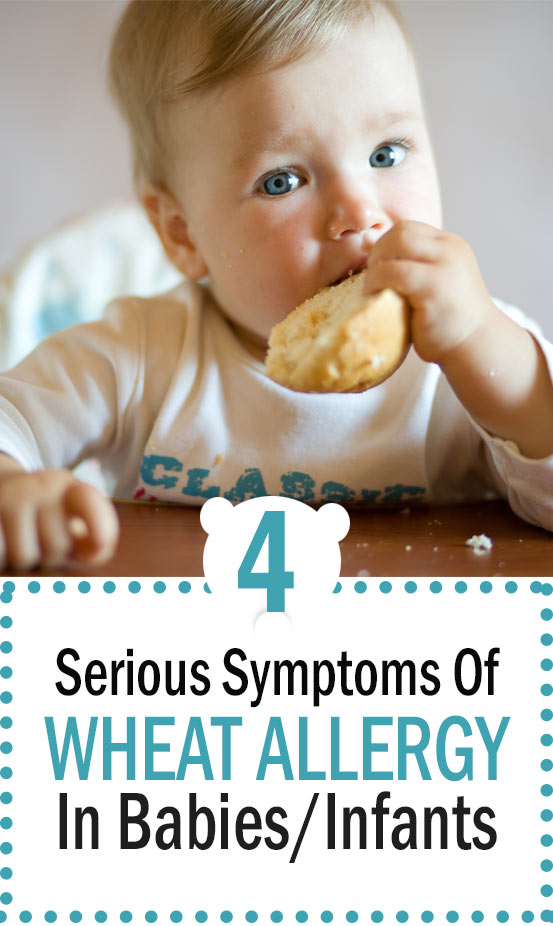 4 Serious Symptoms Of Wheat Allergy In Babies