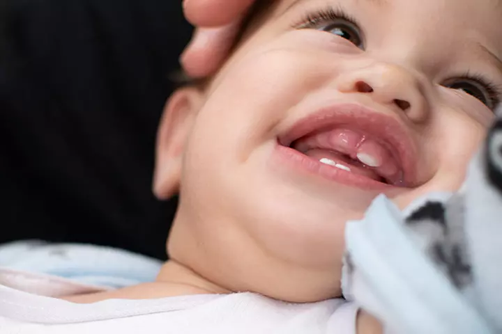 Normal swollen gums in babies