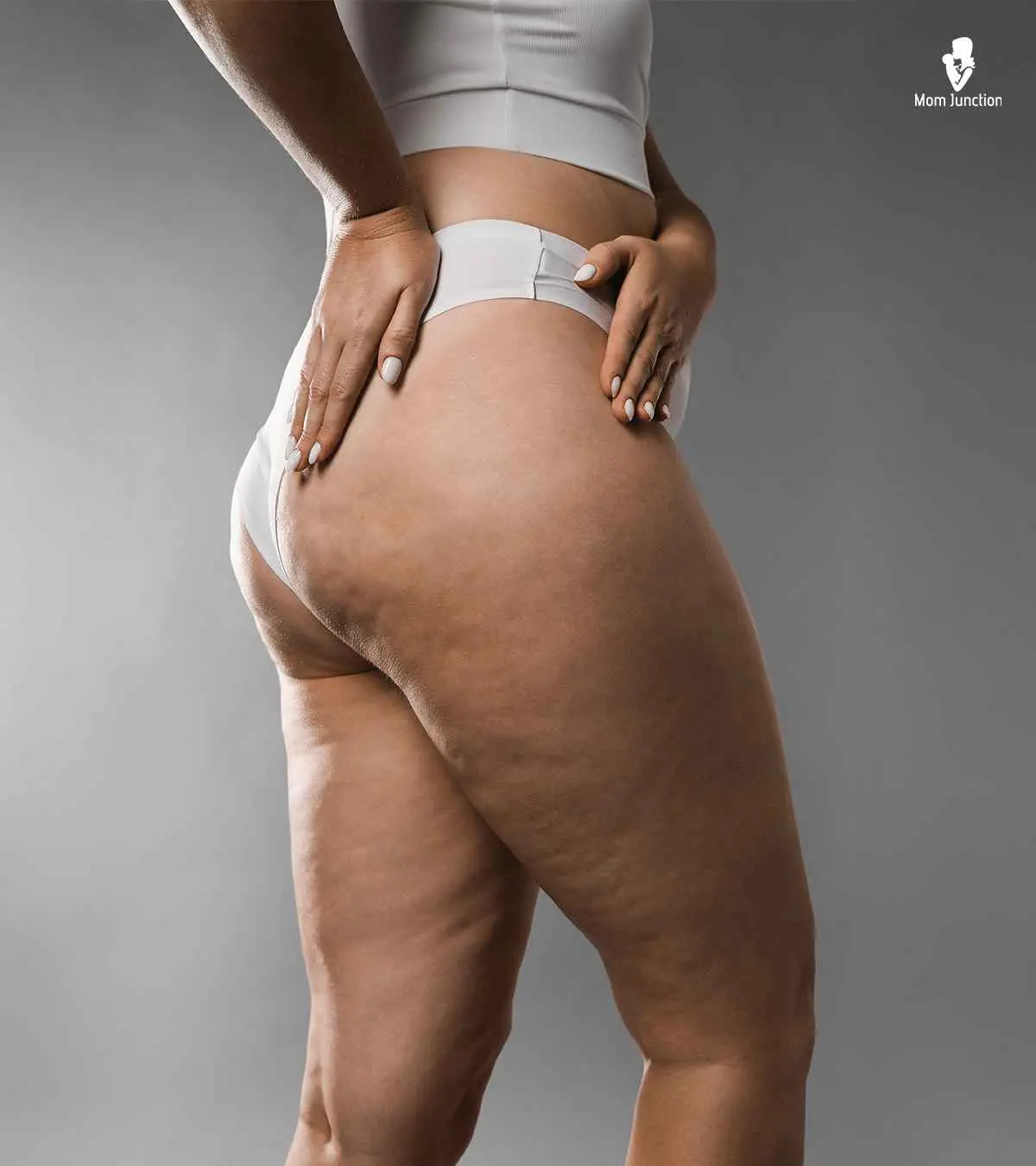 Cellulite In Teens