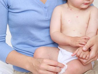 Is It Safe To Use Mosquito Repellents For Babies?