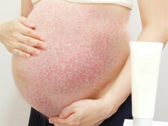 PUPPP Rash During Pregnancy Symptoms, Causes And Treatment