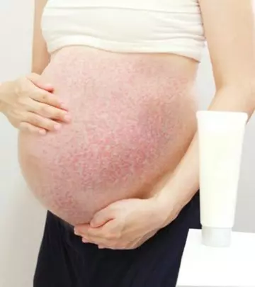 PUPPP Rash During Pregnancy Symptoms, Causes And Treatment