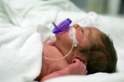12 Premature Birth Complications You Should Be Aware Of