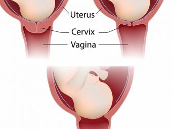 What Happens To Your Cervix During Birth Or Labor?