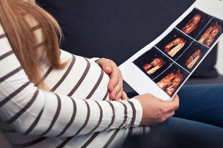 4D Ultrasounds are usually safe