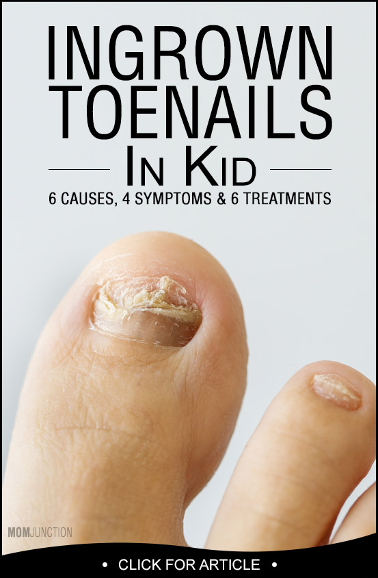 ingrown-toenail-infection-symptoms-treatment-causes