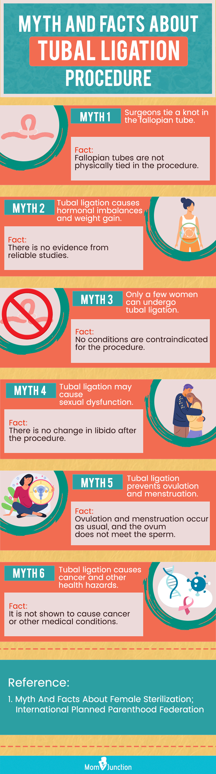 facts about tubal ligation procedure [infographic]