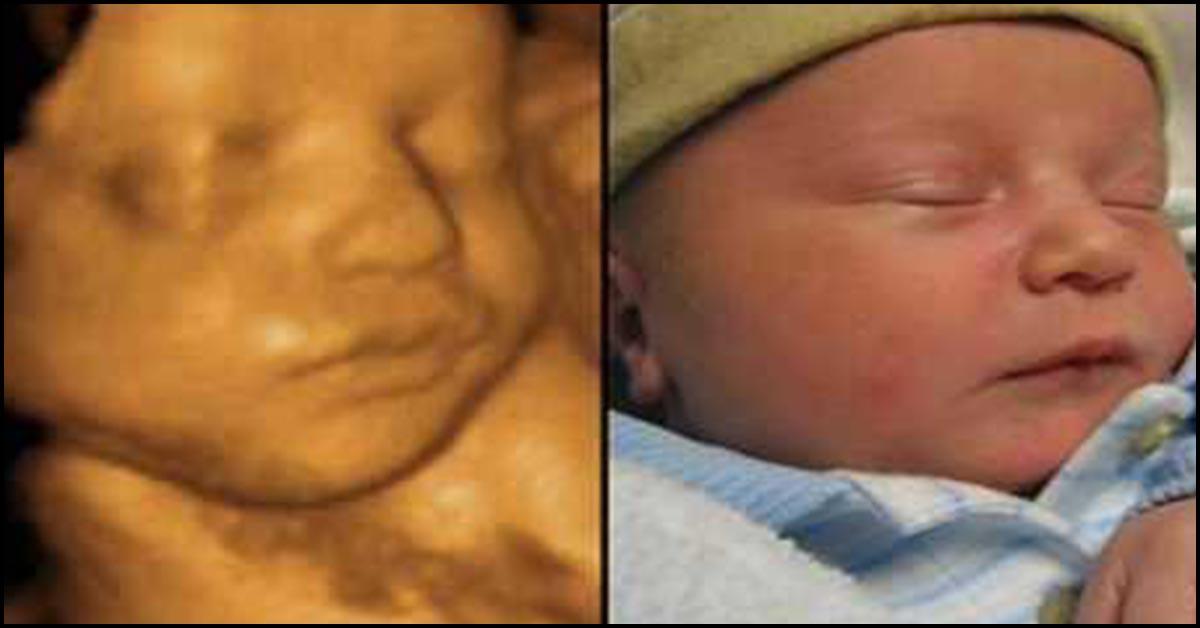 4d ultrasound pictures boy