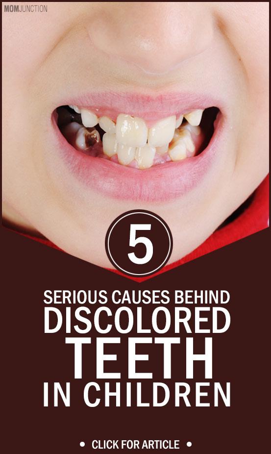 7 Causes Behind Discolored Teeth In Children And Treatment
