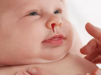 Scabies In Babies Causes Signs Treatment And Remedies