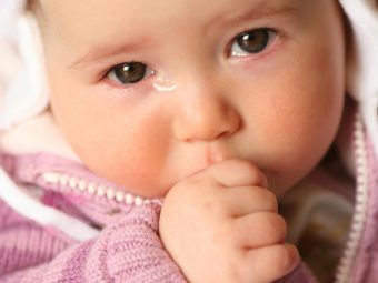 6 Causes Of Watery Eyes In Babies, Treatment And Remedies