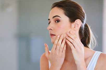 What Causes Postpartum Acne And How To Manage It?