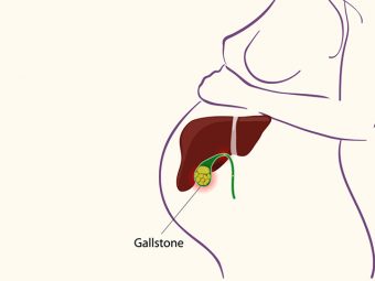 Gallstones During Pregnancy - Everything You Need To Know