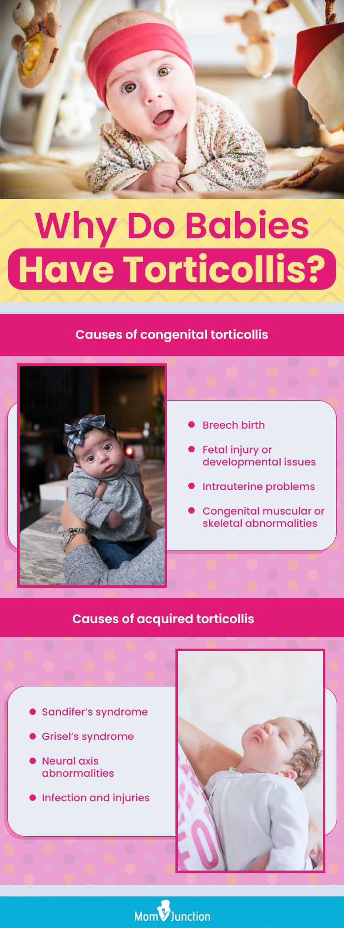 why do babies have torticollis (infographic)