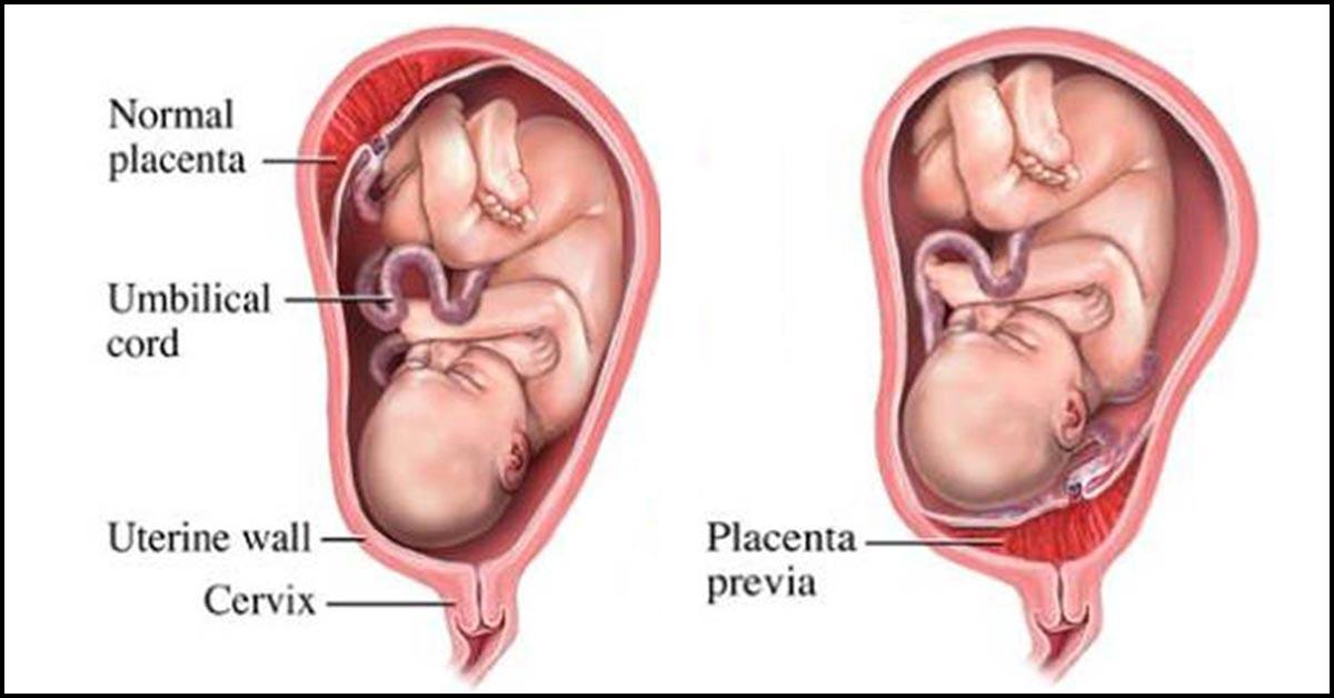 placenta-teaching-tool-for-childbirth-education-childbirth