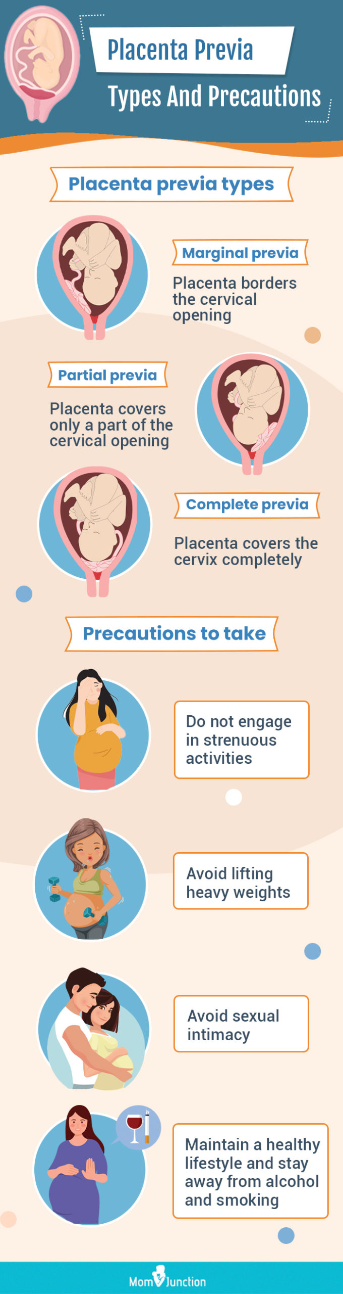 placenta previa types and precautions (infographic)