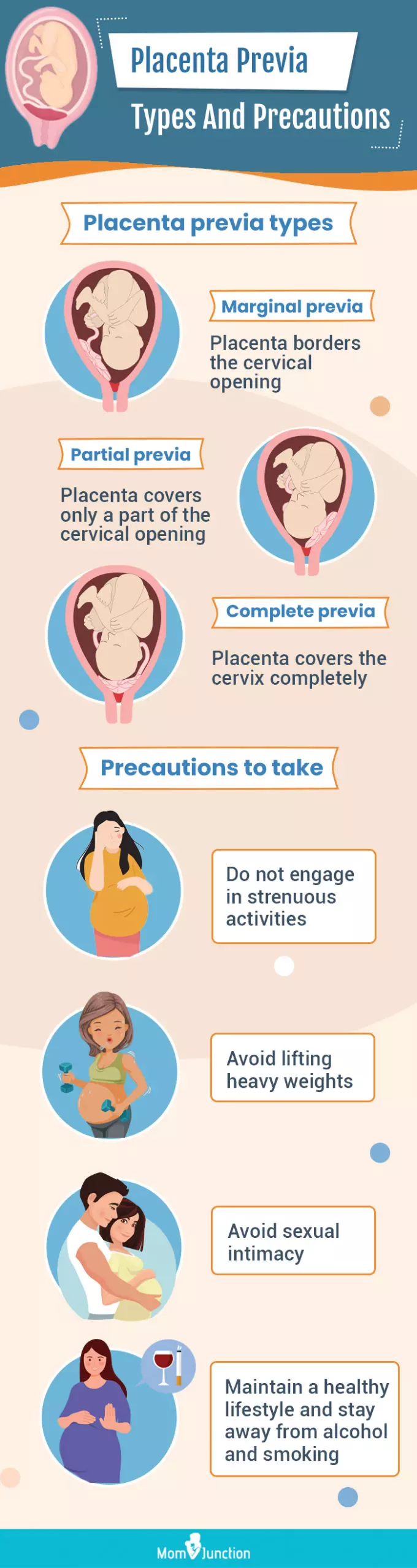 placenta previa types and precautions (infographic)