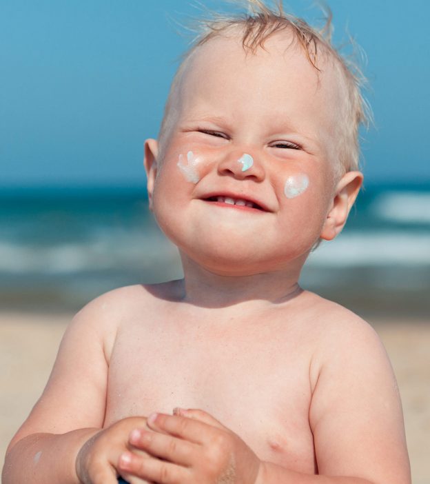 Baby Sunburn Signs Causes Treatment And Prevention