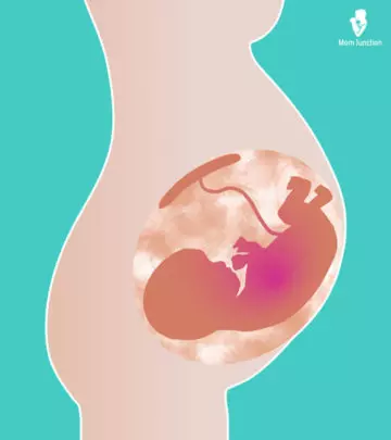 It is best to consult your doctor soon if you suspect amniotic fluid leakage to avoid any severe effects.